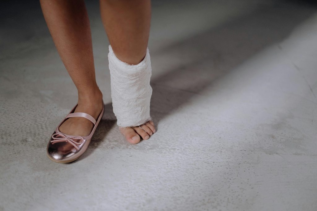 A ballet dancer with an injured foot in a cast.